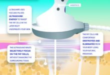 Photo of Important Thing You Need To Know About UltraShape