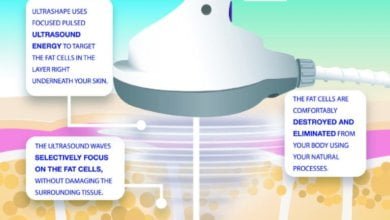 Photo of Important Thing You Need To Know About UltraShape