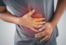 Photo of Life Expectancy After Stomach Cancer Diagnosis
